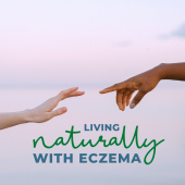 Living Naturally With Eczema Tip: My Favorite Herbs And How To Use Them